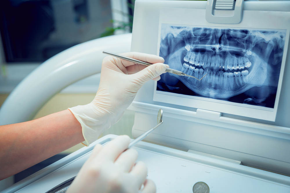 What is Surgical Orthodontics? | Davis Orthodontics
